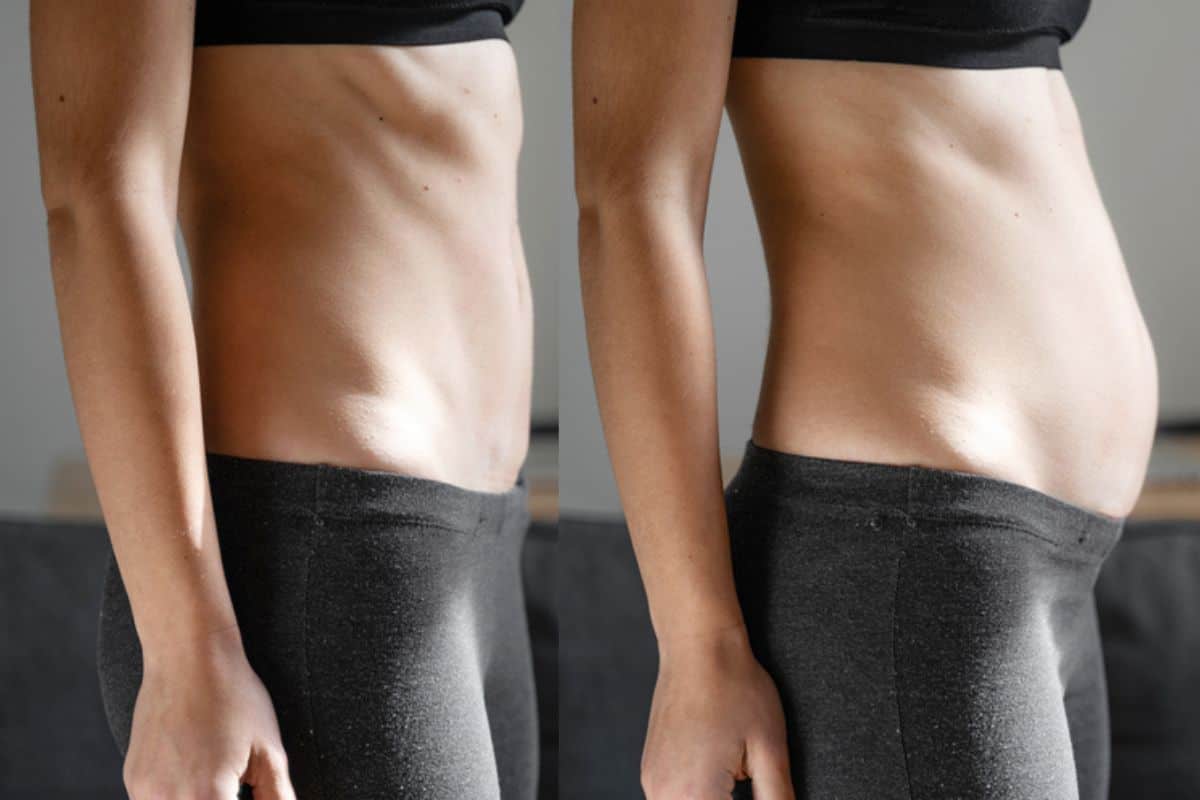 How long does diastasis recti take to improve Walsall?