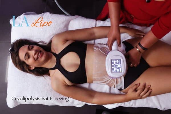 woman getting cryolipolysis Walsall
