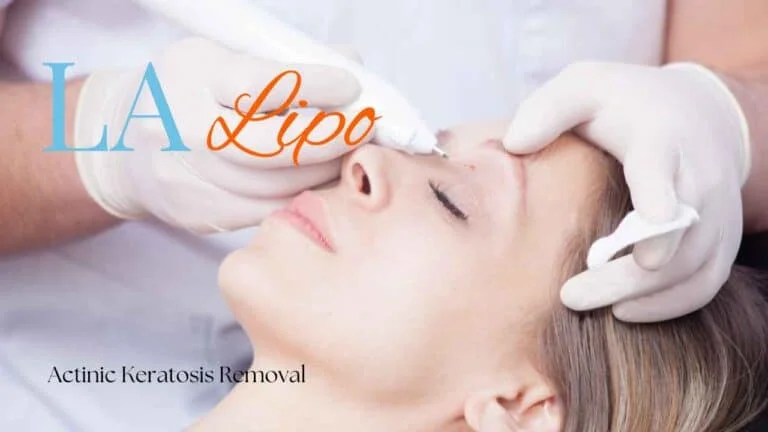 Woman receiving Actinic Keratosis Removal Treatment Walsall