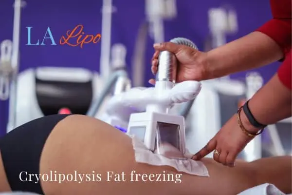 women getting fat freezing Walsall