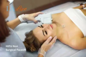 Woman having Hi-Fu to reduce wrinkles Walsall.