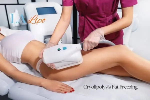 Woman receiving coolsculpting Walsall treatment on her thighs