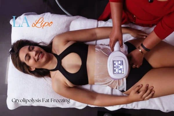 woman getting cryolipolysis Walsall