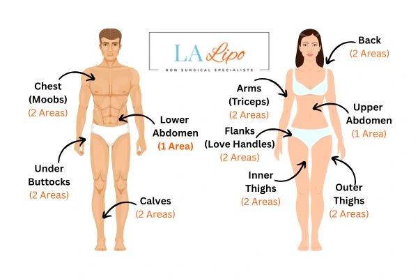 LA LIPO Cryolipolysis Areas Walsall