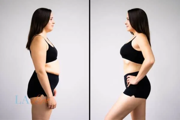 link between body image and mental health Walsall