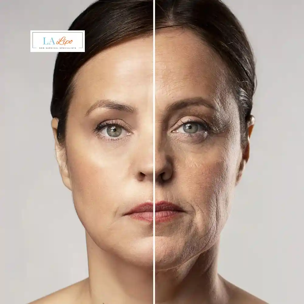 How Can You Tell If Non-Surgical Skin Tightening Is Right for You Walsall?