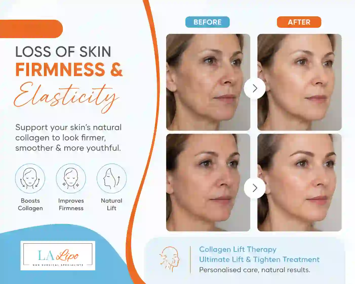 Sign #7: Loss of Skin Firmness and Elasticity Walsall